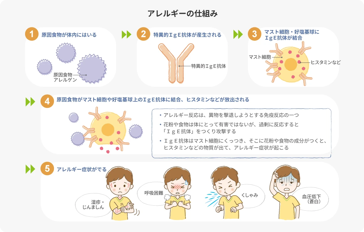 アレルギーの仕組み